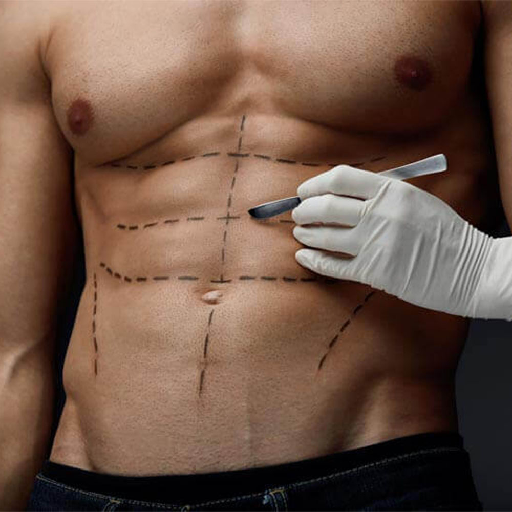 SIX PACK AND TWO PACK SURGERY